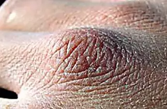Itching This Body Part May Help Blood Sugar Levels