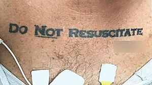 A man's tattoo left doctors debating whether to save his life