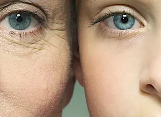 Asì he obtenido una piel más joven y bella de forma natural