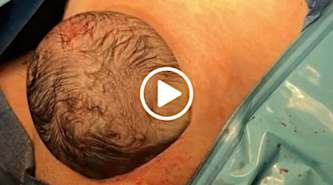Incredible Footage Shows A Baby Being Born Via A 'Natural C-Section'