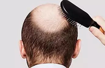 Simple Solution To Regrow Hair Flying Off Shelves