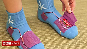Smart socks send data to your physio