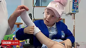 Girl, 7, has leg reattached backwards