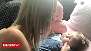 Quadruple amputee girl is welcomed home