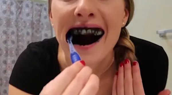 Novo clareador caseiro sem colaterais choca a internet