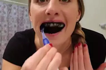 Novo clareador caseiro sem colaterais choca a internet