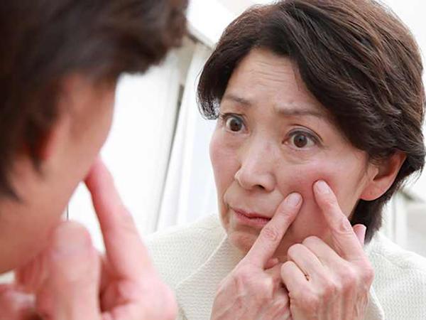 「目の下の暗さ」をなおしたい人必見!簡単で安心な必見アイテムとは