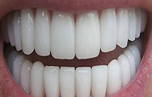 1 Tip That Finally Turned Yellow Teeth White