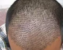 Hágalo antes de ir a dormir para regenerar su cabello durante la noche