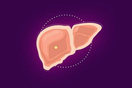 Know the Signs and Symptoms of Liver Cancer