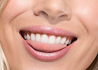 Don't want to pay up to $7k for braces? Straighten your teeth for 60% less.