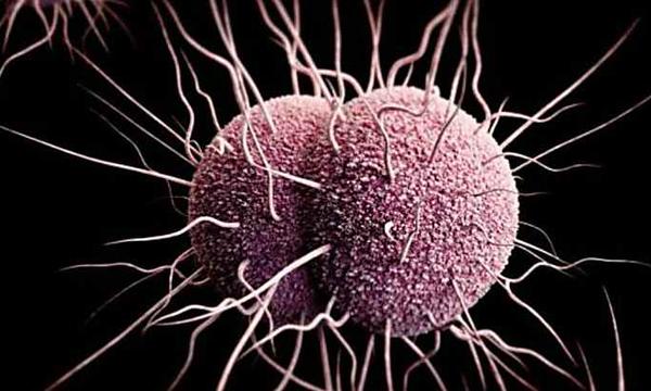 Time is running out for treating gonorrhea
