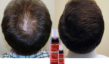 Do this '10 Days' Hair Oil Before Bed To Regrow Your Hair