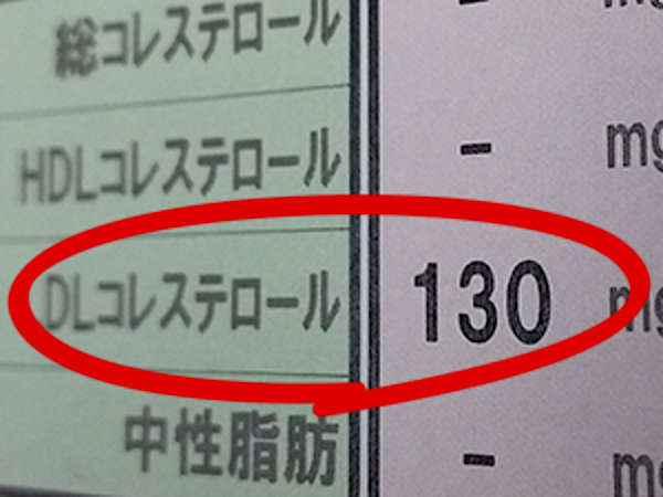 自覚症状がほとんど存在しないサイレントキラーの怖さとは?